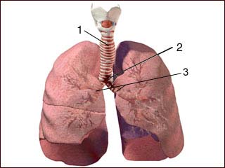 Tracheal / bronchial rupture