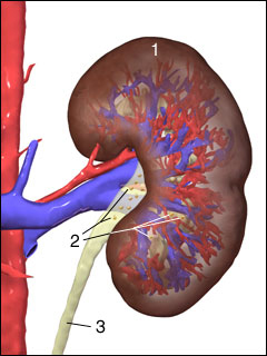 Kidney stones (nephrolithiasis)