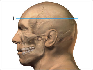 Site of cranial MRI