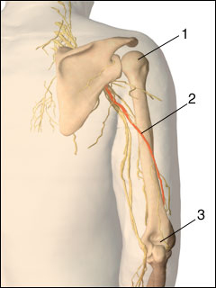 Radial nerve dysfunction