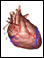 Patent foramen ovale