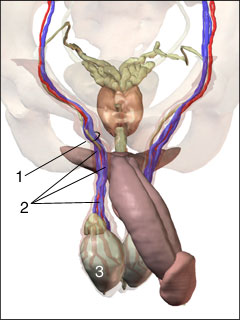 Varicocele (enlargement of the veins of the spermatic cord)