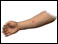 Tuberculosis positive skin test