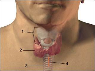 Tracheostomy