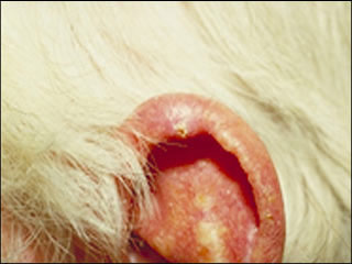 Actinic keratosis (on ear)