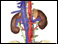 Abdominal aortic aneurysm