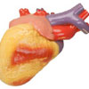 Complications - cardiovascular