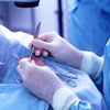 Cosmetic surgery - Procedures