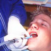 Dental disorders - Caries/infection