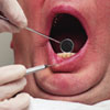 Dental disorders - Keeping healthy teeth