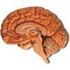Brain tumours - Causes